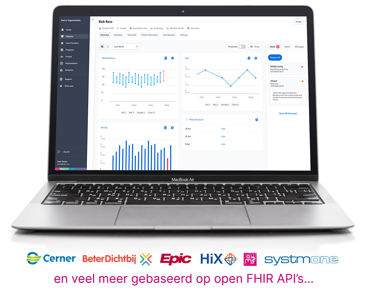 screenshot-macbook-monitor-NL